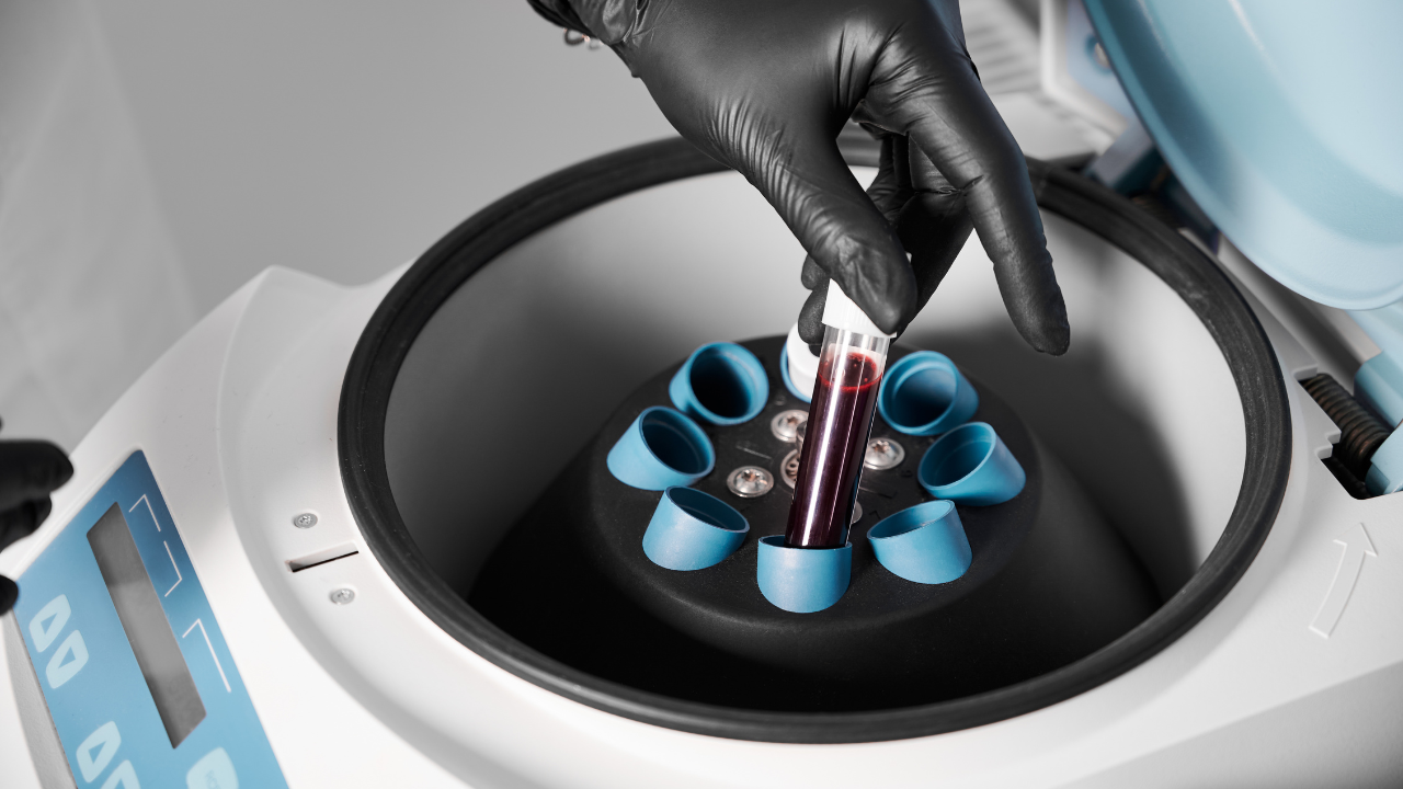 Técnico de laboratorio realizando un análisis clínico